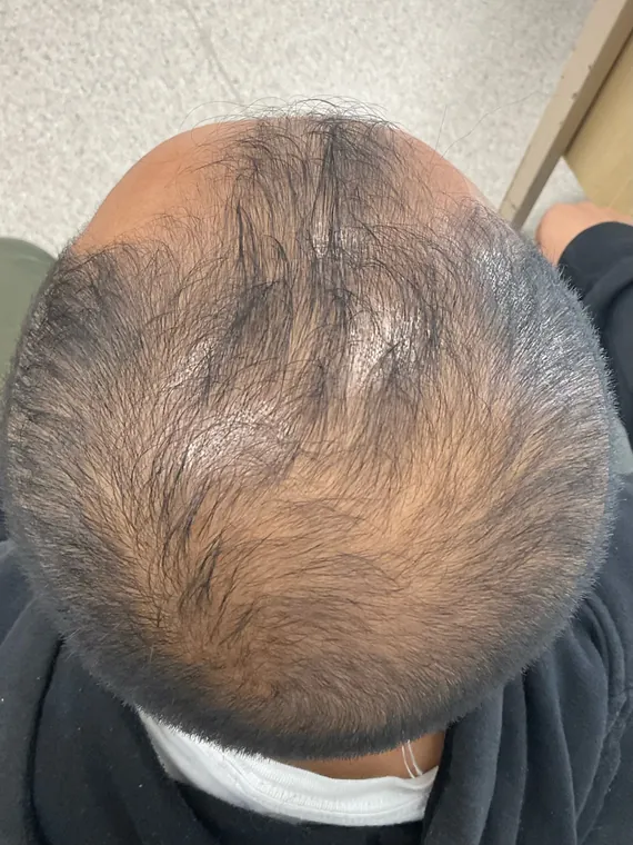 Client 1 before