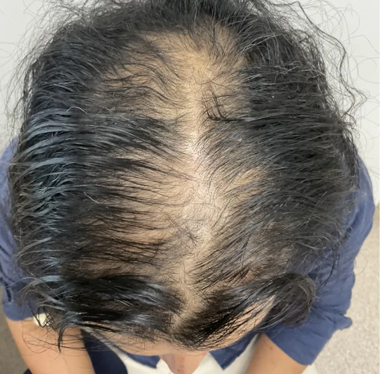 Client 2 before
