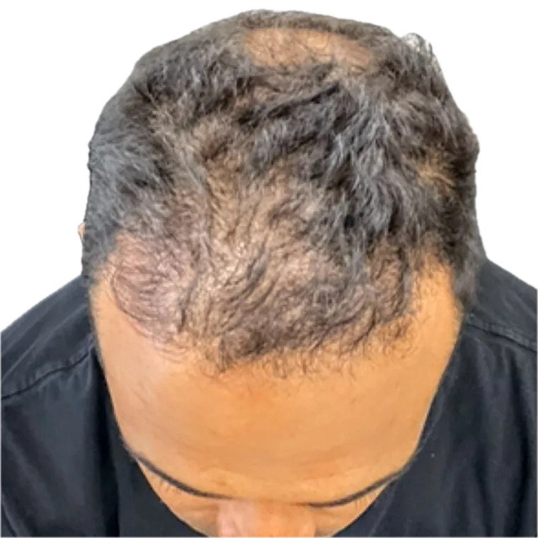 Client 3 after 5 PRF sessions