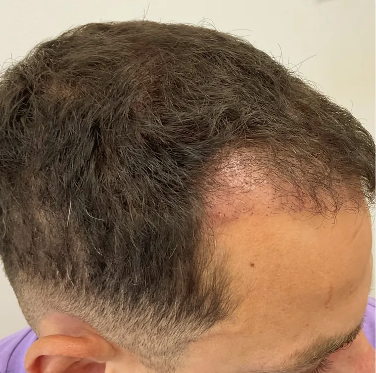Client 4 before