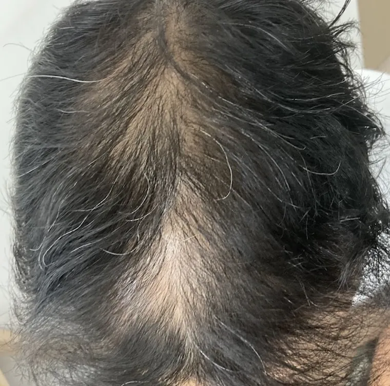 Client 2 after PRF