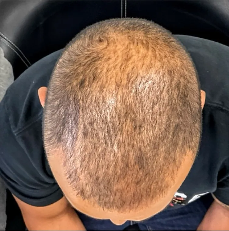 Client 3 before