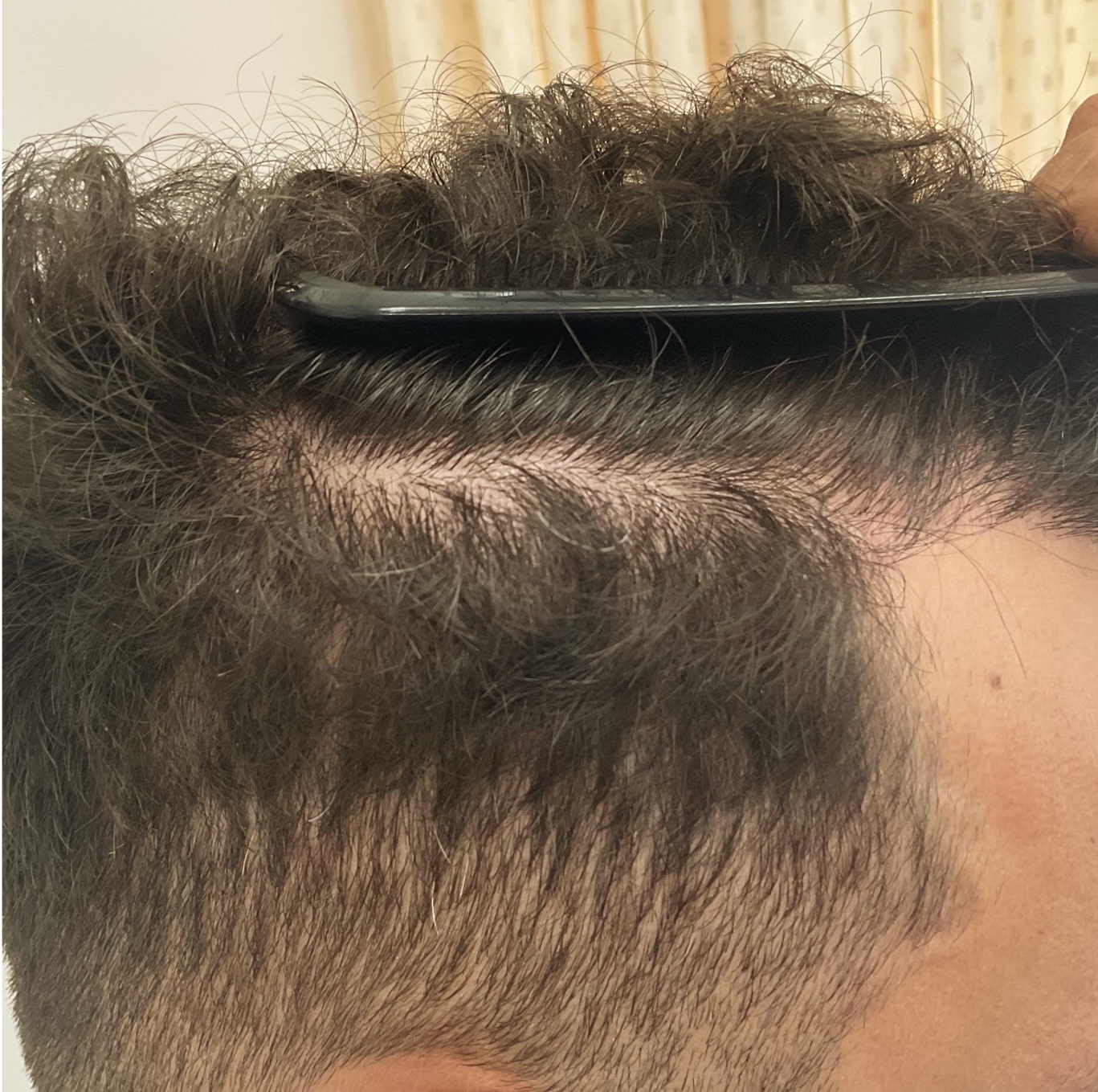 Client 4 after Hair Revive series