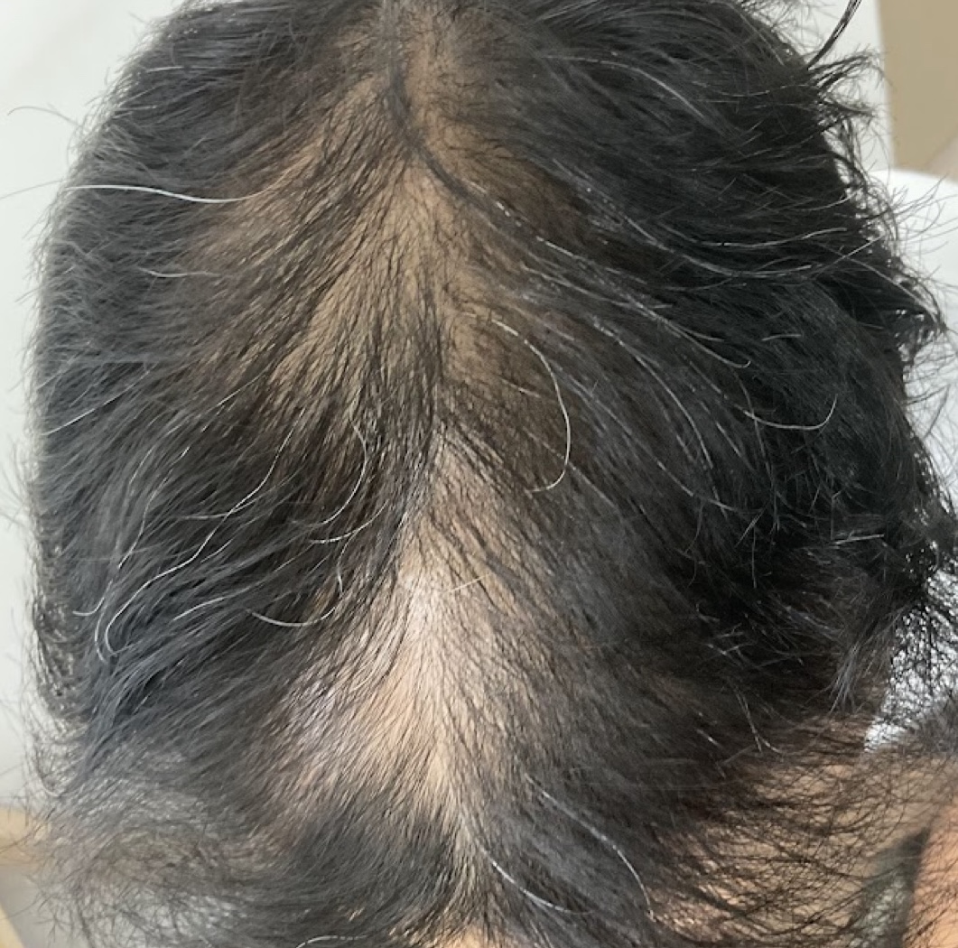 Client 2 after hair revive treatment