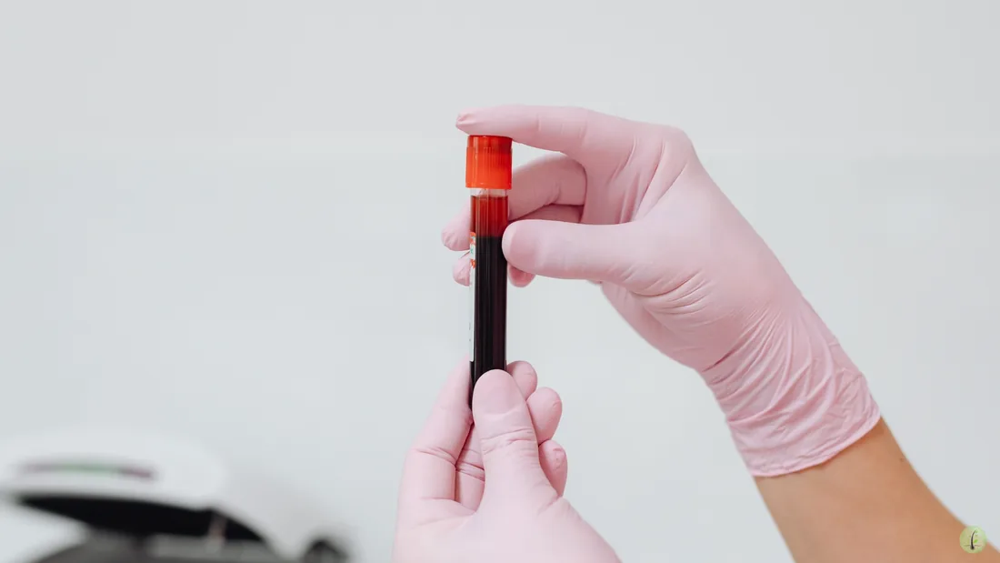 PRF platelet rich fibrin scalp treatment