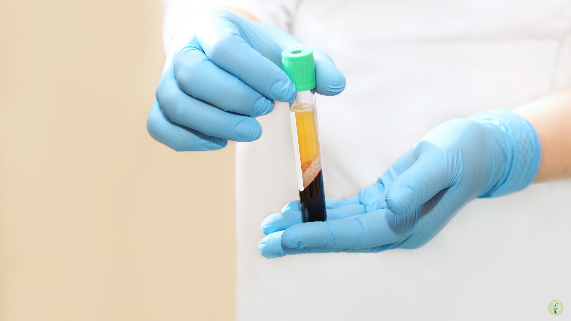 PRP blood plasma centrifuge treatment